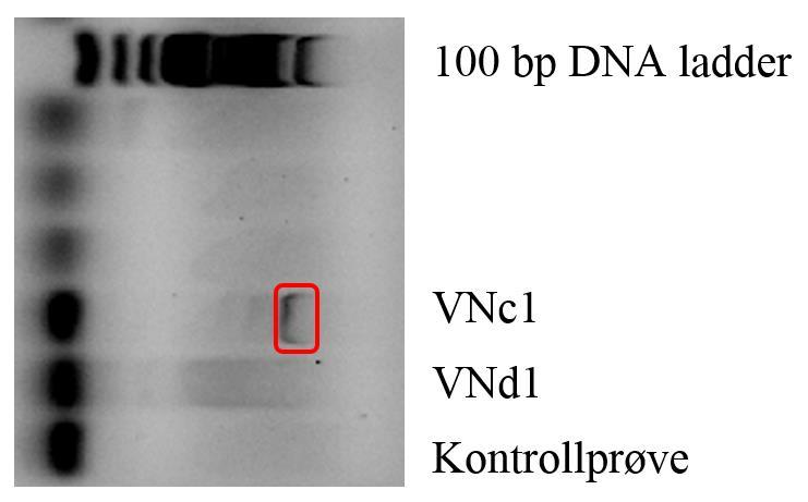 Her er det ett tydelig bånd (prøve Na1*(C)) og ett svakere (Na1* (E)). Plasseringen til båndene ligger rundt 700 bp, som kan stemme overens med SHV genet.
