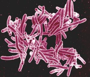 Molekylær deteksjon av Mycobacterium tuberculosis Realtime PCR