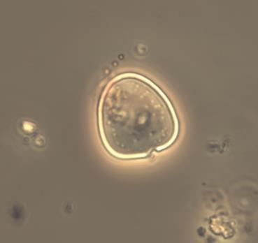lite vind (høy grad av vertikal stabilitet) gir fureflagellater et konkurransefortrinn og kan bygge biomasse. D Figur 4. Planteplankton mengde (*1000 celler/l) ved stasjon Tilremsfjorden (VR31).