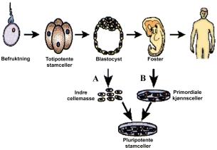Figur 1 To metoder for fremstilling av pluripotente stamceller. A fra overtallige befruktede egg (blastocyst) (Thomsen-metoden). B fra provosert aborterte fostre (Gearhart-metoden).