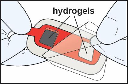 3. Sette på IONSYS hydrogeler Fjern og kast den klare plastfilmen som dekker limet. Pass på at du ikke berører hydrogelene.