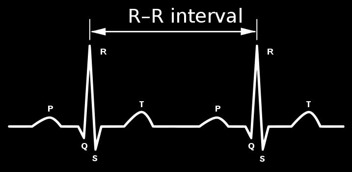 Figur 4: Figuren viser en standard avlesning fra EKG med QRS kompleks og R-R intervall. Figuren er hentet fra wikipedia.com. Målinger av HRV kan utføres på forskjellige måter.