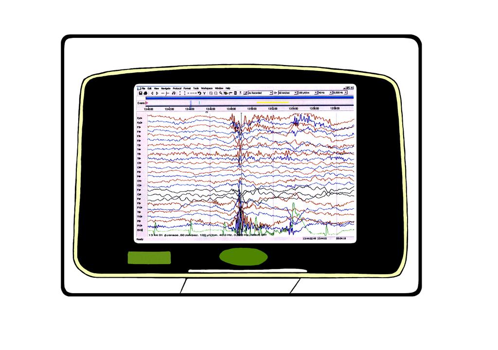 Utredning og behandling EEG og videometri Den første tiden etter at jeg fikk diagnosen epilepsi, trodde jeg at jeg ikke kunne være med på noe lenger. Men det er feil.