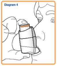 Diagram 4 = Figur 4 6. Hold pusten og fjern inhalatoren fra munnen. Fortsett å holde pusten så lenge det er komfortabelt. Ikke pust ut i inhalatoren. 7.