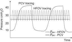 HFOV (Oscillator) Frekvens 8-10Hz sykler/s: Hz MAP +1-2 cmh 2 0 mean airway pressure (cmh 2 O) Amplitude delta P, svingninger rundt MAP rister i lysken Poor Oxygenation Over Oxygenation Under