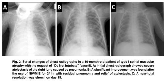 muscle weakness (B).