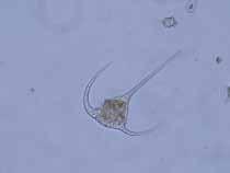 dinoflagellaten Ceratium tripos.