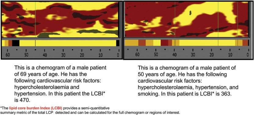 NIRS near-infrared