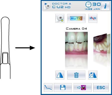 5.8. INTRAORALT KAMERA C-U2 C-U2 er et spesielt utformet intraoralt kamera for enkel bruk i forbindelse med intraoral dental undersøkelse.