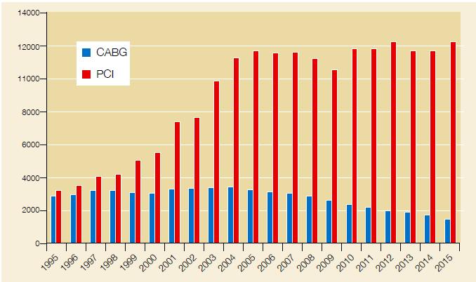 PCI versus CABG