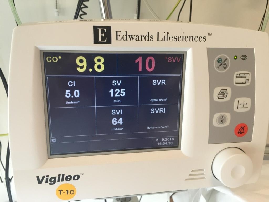 Vigileo Kobles til arterikran i arteria radialis