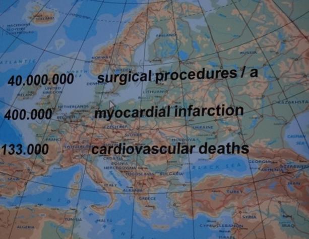 Preoperativ vurdering Europa antall pas til kirurgi øker