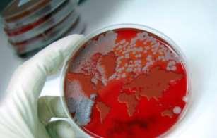 Antibiotikaresistente mikrober Multiresistente Gram negative staver: ESBL,