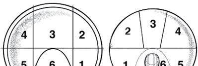 RETTLEDNING 1. HOFTEDYSPLASI Kriterier: AI > mean + 2SD for aktuell alder (Se figur) Alle barn som på røntgen bekken får påvist hoftedysplasi etter 3 måneders alder skal registreres.