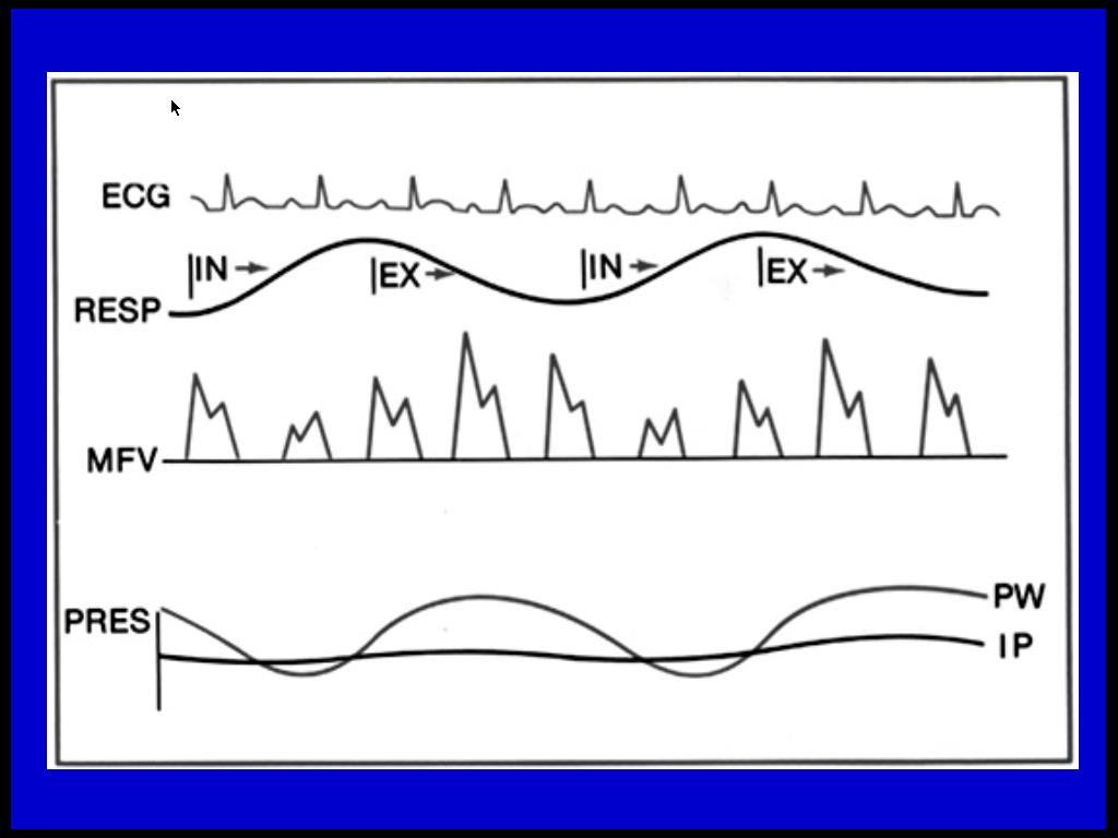 Hemodynamikk ved