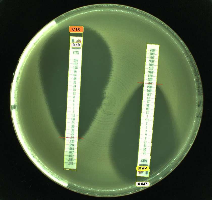 Strips Agar gradient diffusjon Seint voksende, kravfulle, anaerobe ++ MIC (mg/l) der ellipsen krysser