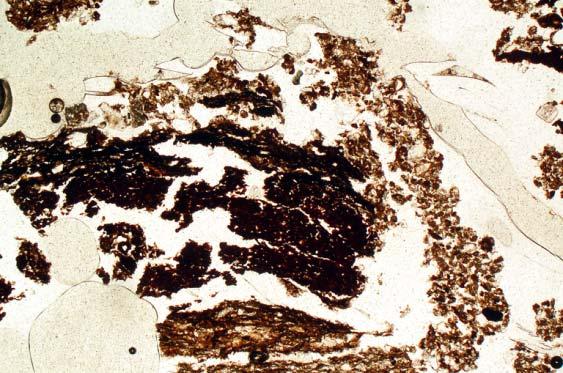 34: Photomicrograph of M13145D (Trackway), junction of subsoil and overlying