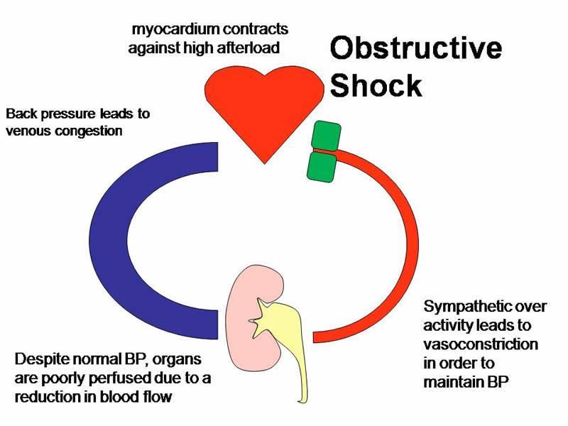 Scottish Intensive Care