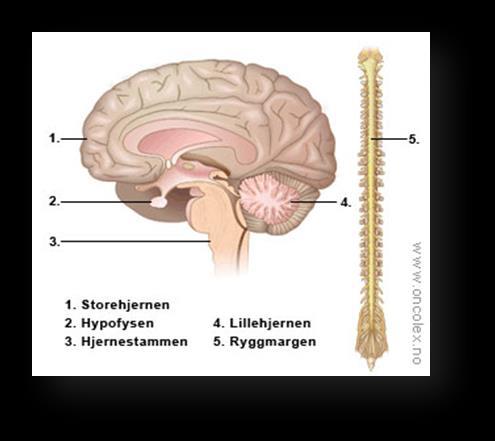 Spastisk lammelse «Upper Motor Neuron Syndrome» Sentralnervesystemet består av hjernen og ryggmargen Ved skade kan spastisk lammelse oppstå Signalene mellom hjerne og musklene kommer ikke frem som