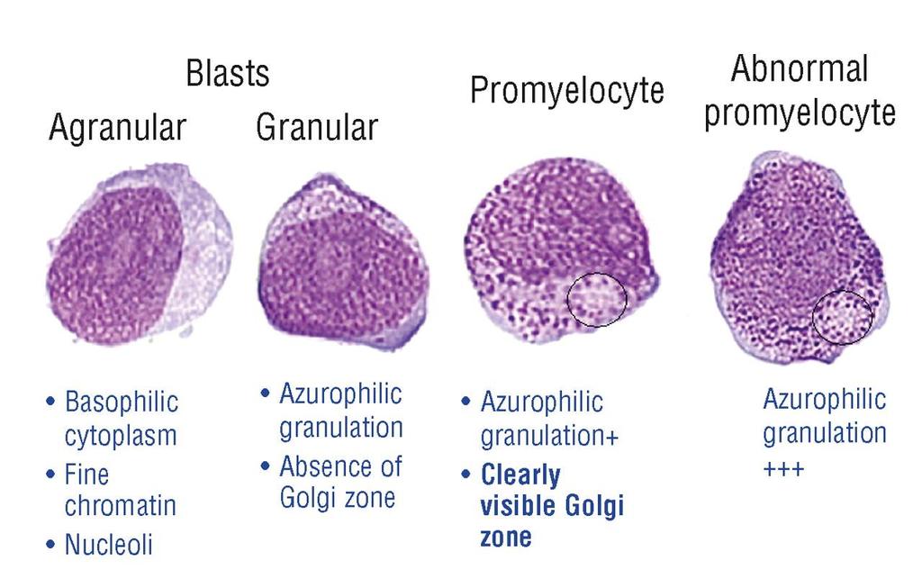 Blasts, promyelocytes, abnormal promyelocytes. Ghulam J.