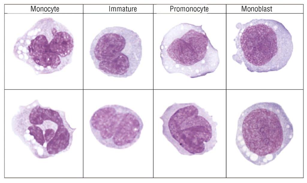 Example of monocyte subtypes as circulated for evaluation. Jean E.