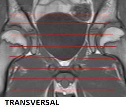 sacrum, inkludert bukvegg. T1 eller DUAL COR 320 +++ 6/ 15 % 1,12 x 1,4 Hele bekkenet fra symfysen til og med sacrum, inkludert bukvegg.