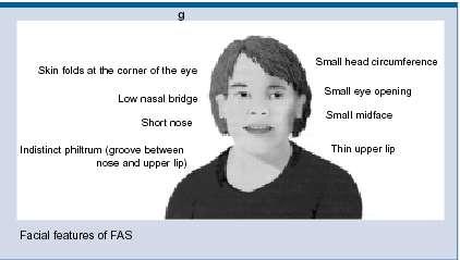 (?), ADHD (?) -2-3 enheter per uke: Økt sjanse for tidlig fødsel, abort.