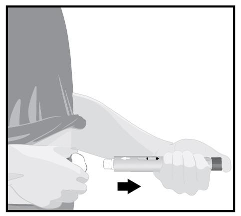 STEG 8 Flytt den ferdigfylte pennen sakte vekk fra huden når injeksjonen er ferdig. Den hvite nålbeskyttelsen vil dekke over nålspissen.