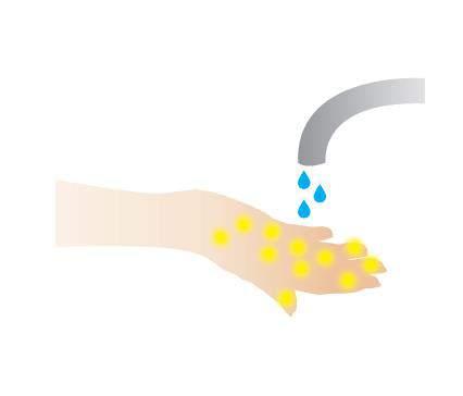 Utfordringer med håndhygiene Dårlig etterlevelse av hånd hygiene Utføres i mindre enn halvparten