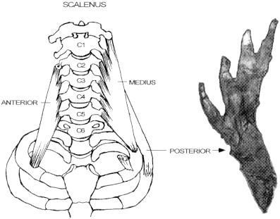Structure of scalenus muscles. The three heads of scalenus have varying patterns of tendinous attachment, only one of which is illustrated in the schematic drawing (left).