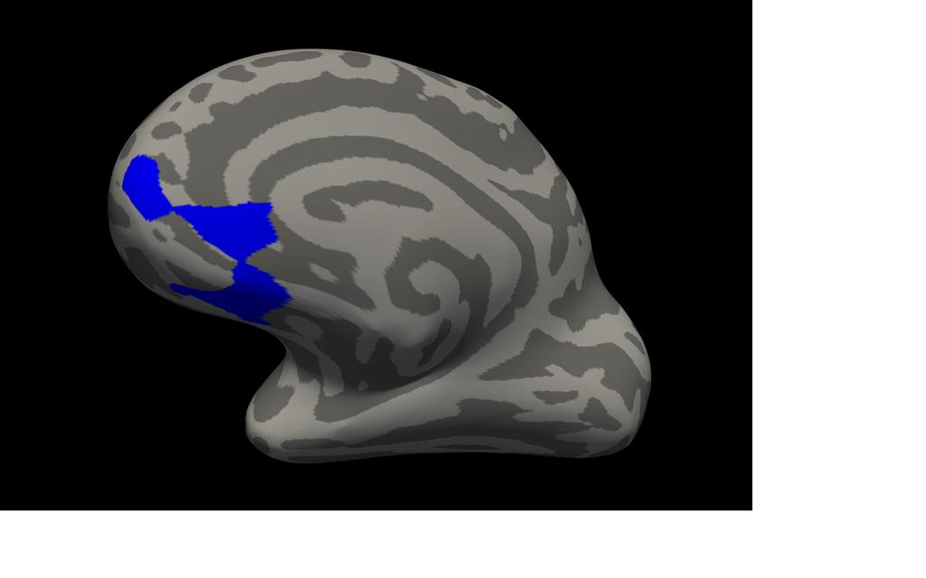 entorhinal korteks og rostal anterior cingulate (racc). Figur 2.