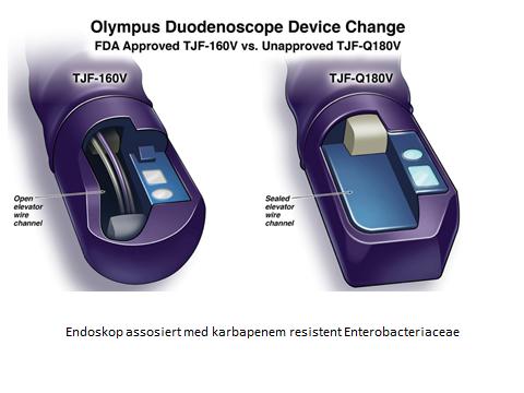 Uønskede hendelser I 2010 endret Olympus design av Duodenoscope TJF 160V (venstre) som hadde «åpen elevatorwirekanal» til wirekanal som var forseglet, nemlig TJF Q180V.