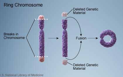 Typer endringer: kromosomnivå