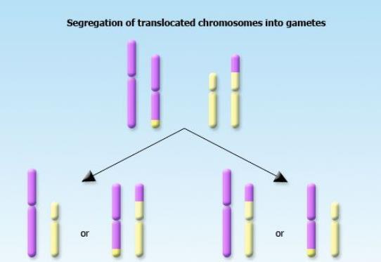 En forelder med en balansert translokasjon mellom to kromosom Mulige gameter Ingen t balansert ubalansert ubalansert