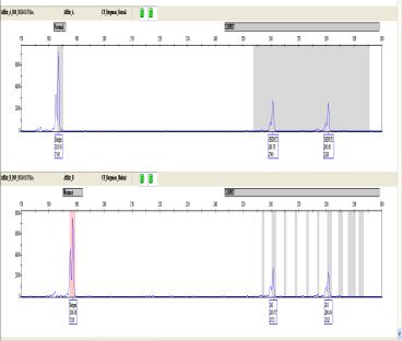 probeplassering Karyotyping - påvisning av store