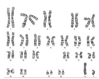 Hvordan gjenkjenner vi kromosomer Hvert enkelt kromosom har en bestemt lengde, og pakkes på bestemte måter (tett/mindre tett) Karyotype Hvis vi tar ut cellekjerner, og farger dem rett før de har