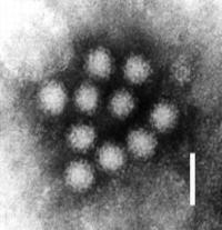 Norovirus SYMPTOMER: uvelfølelse kvalme brekninger magesmerter muskelverk diaré feber.