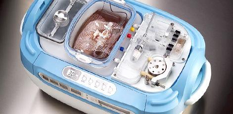 LifePort kidney perfusion Studies have shown that machine perfusion of Extended Criteria Donor (ECD) kidneys improves graft survival during the first year post-transplant and lowers the rate of