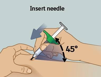 8) Sett inn nålen Sett inn nålen Hold sprøyten i en ca.