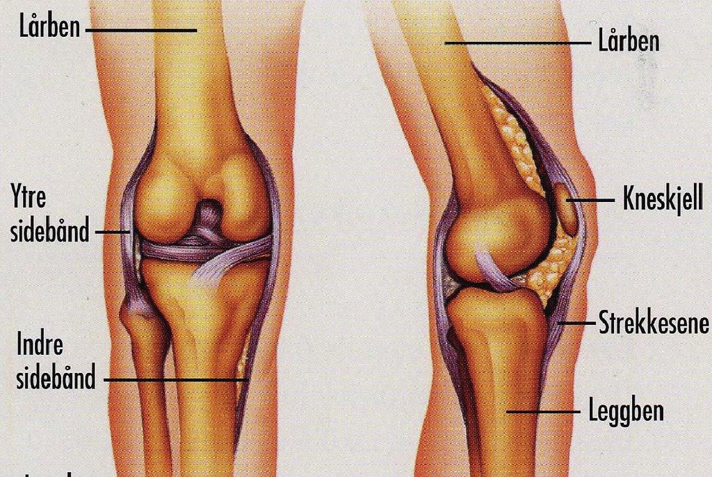 Det er viktig at du så raskt som mulig kommer i gang med å bruke det opererte benet etter operasjonen.