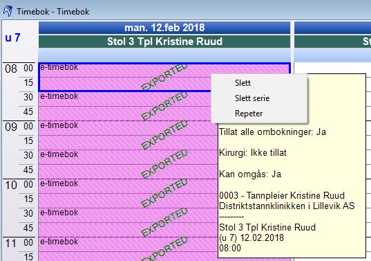 Relatert informasjon For å ta bort preblokkeringer i timeboken, høyreklikk på preblokkeringen, velg Slett eller Slett serie.