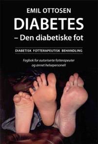 Last ned Diabetes - den diabetiske fot - Emil Ottosen Last ned Forfatter: Emil Ottosen ISBN: 9788230015599 Antall sider: 213 Format: PDF Filstørrelse:22.
