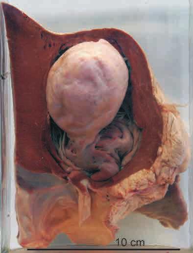 Pehme südamesisekesta-sidekudekasvaja (fibroma endocardii molle) funiculi spermatici post castrationem).