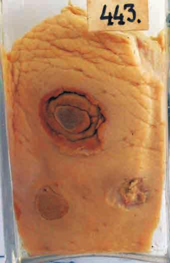 Imeti-kiirikseentõbi (actinomycosis mammae) seal taudidest, mida tänapäeval Eestis enam ei esine. BAKTERIOOSID.