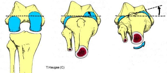 5.24 Vridning av femur på tibia i en ekstensjon Tibia og fibula Tibia og fibula Tibia og fibula Fig 094.