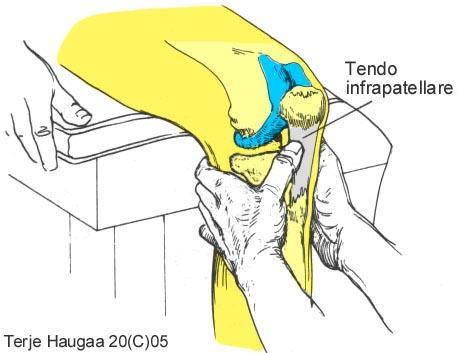 6.4 Palpasjon av tendo infrapatellare T. Haugaa Fig 107.