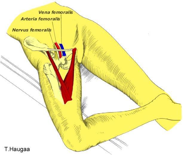 8.41 Arterie, vene, og nerve i lysken Fig 172. Lokalisering av arteria femoralis, vena femoralis, og nervus femoralis.