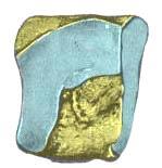 1.13 Venstre os cuneiforme intermediate sett fra et medialt aspekt Facies articularis cuneiforme mediale