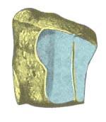1.14 Venstre os cuneiforme intermediate sett fra et lateralt aspekt Facies articularis naviculare Facies