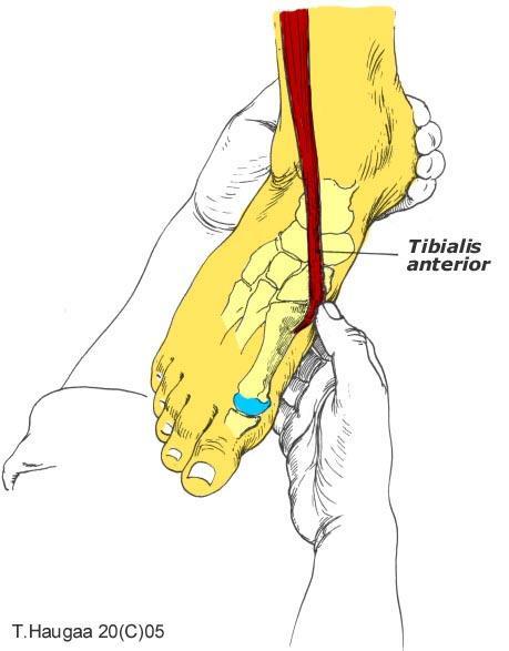 4.30 Musculus tibialis anterior T. Haugaa Fig 062.